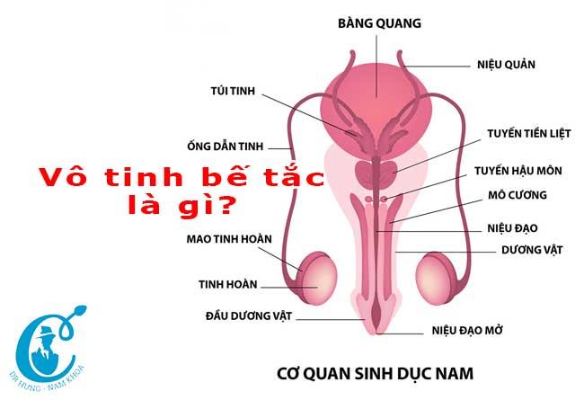 Vô tinh bế tắc và phương pháp điều trị