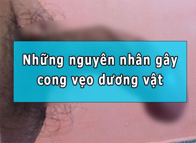 Cong vẹo dương vật và nguyên nhân cong vẹo dương vật