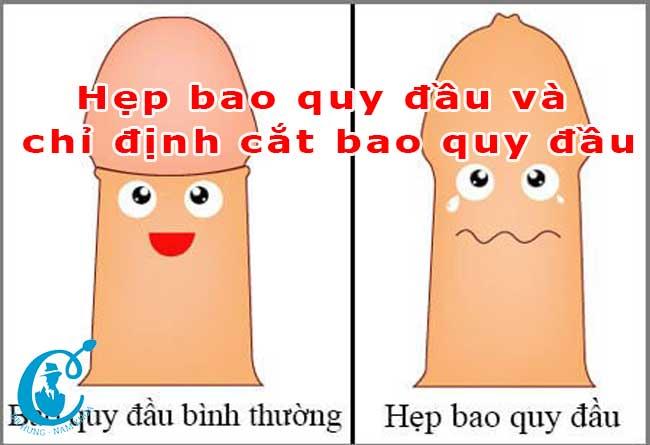 Hẹp bao quy đầu và chỉ định cắt bao quy đầu