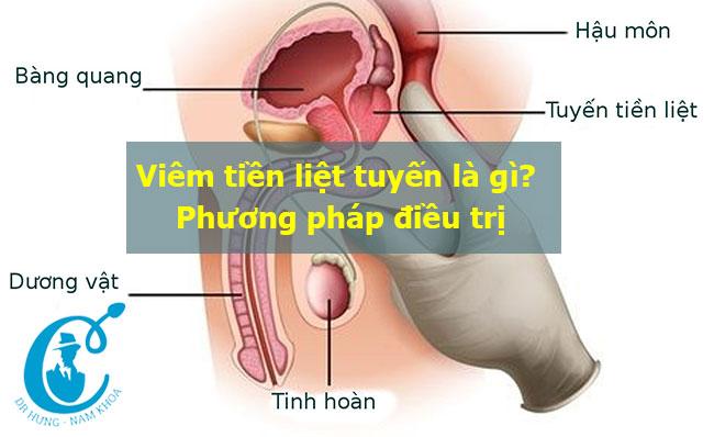 Viêm tiền liệt tuyến là gì? Phương pháp điều trị