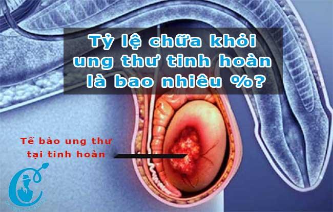 Chuẩn đoán và phương pháp điều trị ung thư tinh hoàn