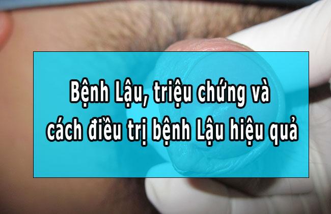 Bệnh Lậu, triệu chứng và cách điều trị bệnh Lậu hiệu quả