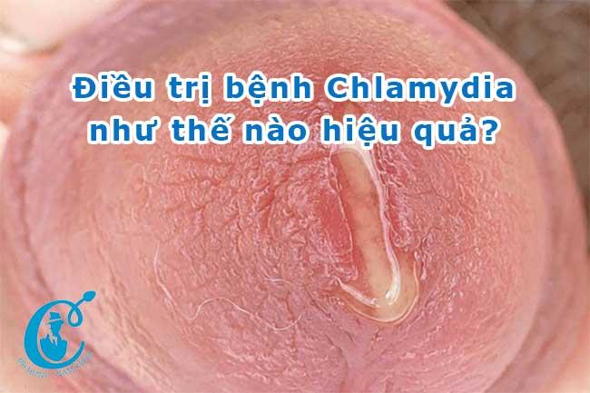 Tìm hiểu về bệnh Chlamydia và phương pháp điều trị bệnh Chlamydia