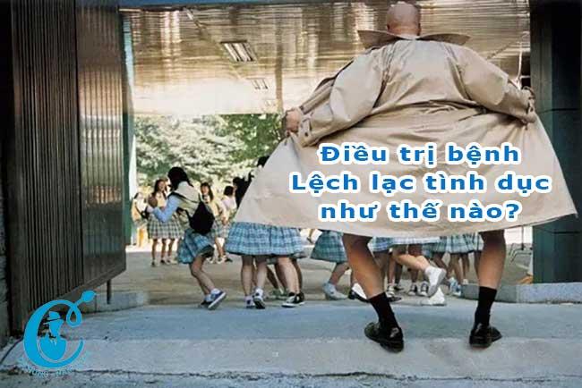 Lệch lạc tình dục và cách điều trị bệnh lệch lạc tình dục