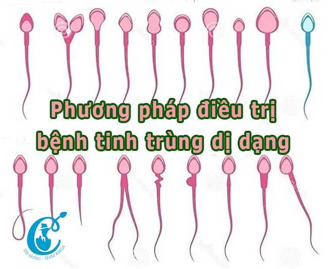 Tinh trùng dị dạng là gì? Chữa bệnh tinh trùng dị dạng thế nào?