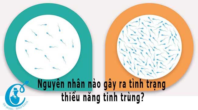 Thiểu năng tinh trùng và cách cải thiện số lượng tinh trùng