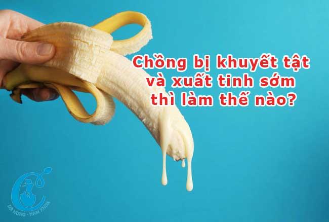 Chồng bị khuyết tật và xuất tinh sớm thì làm thế nào?