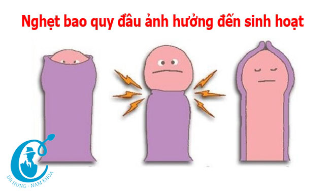 Nghẹt bao quy dẫn đến tổn thương dương vật