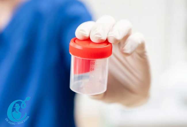 Bảo quản thực hiện dễ dàng và không tốn kém