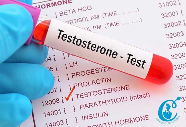 Cần đi khám và test nồng độ testosterone 