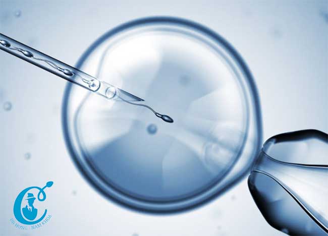 Hỗ trợ điều trị vô sinh vì tinh trùng dị dạng bằng thu tinh ống nghiệm