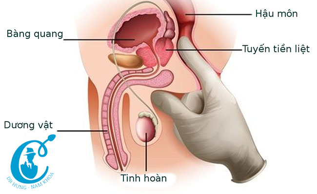 Cách khám viêm tiền liệt tuyến