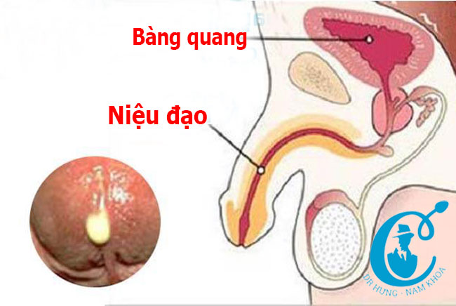 Vị trí niệu đạo trong bộ phận sinh dục